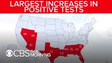 Coronavirus cases in Florida continue to climb as ...
